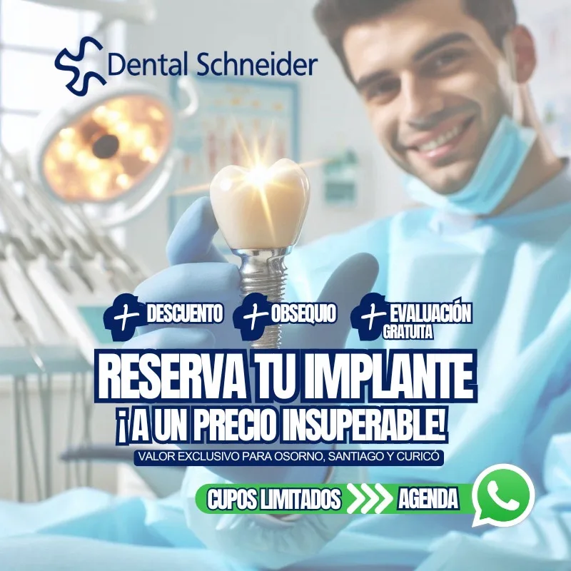Implante Dental